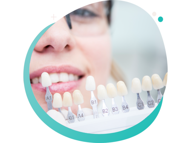 Esthétique dentaire, facettes en porcelaine et blanchiment professionnel